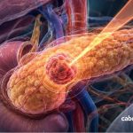 ​"Ensaio clínico norte-americano mostra que radioterapia ablativa permitiu operar um em cada quatro doentes antes considerados sem hipótese cirúrgica"