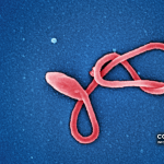 Micrografia eletrónica colorizada de uma partícula filamentosa do vírus Ébola, captada pelo NIAID. Imagem científica ilustrativa; não mostra a doente confirmada na Nigéria.
