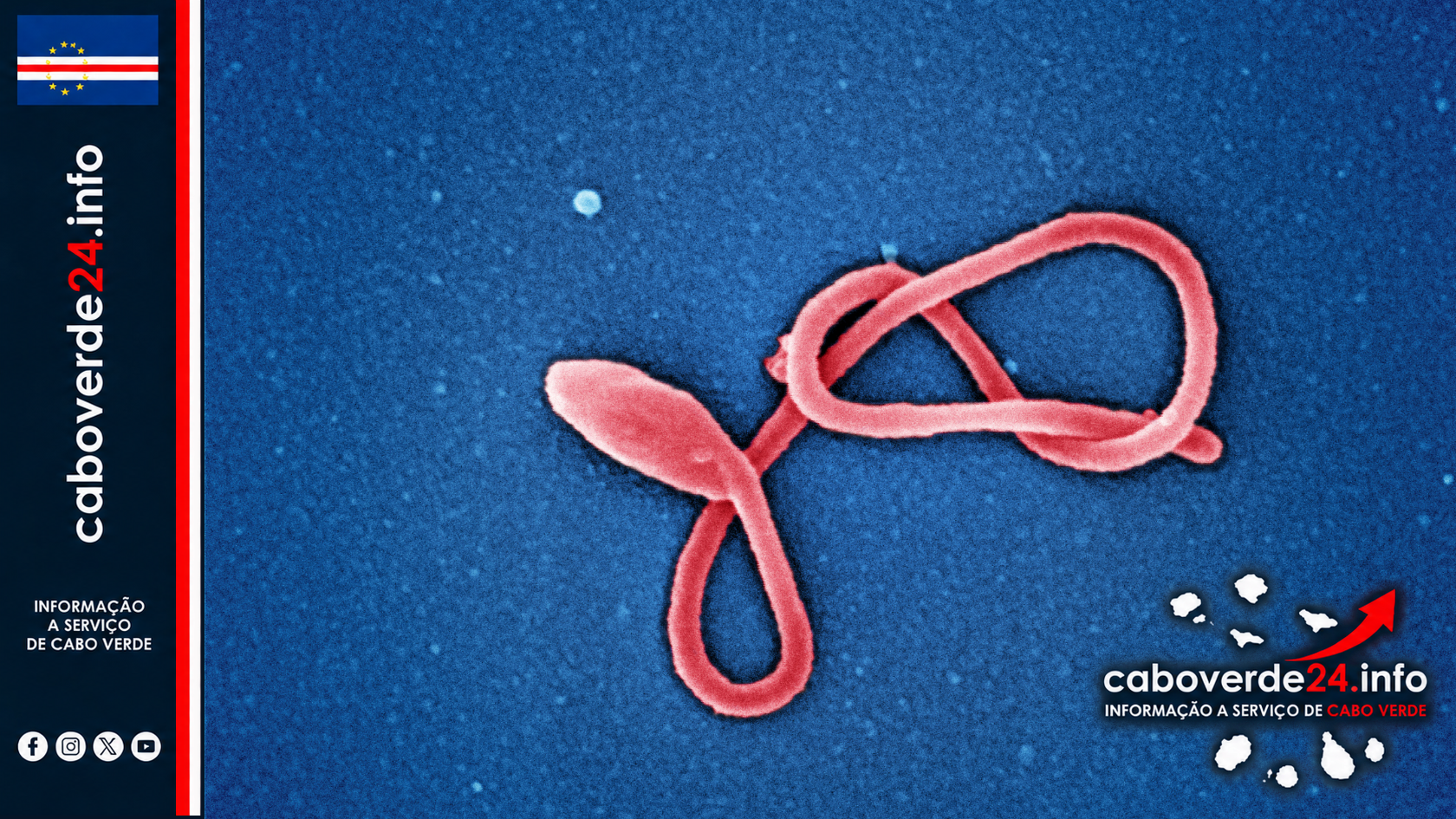 Micrografia eletrónica colorizada de uma partícula filamentosa do vírus Ébola, captada pelo NIAID. Imagem científica ilustrativa; não mostra a doente confirmada na Nigéria.