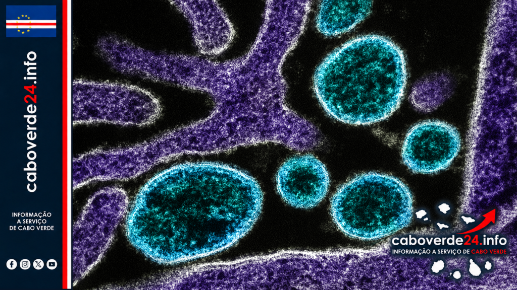Imagem científica de arquivo — partículas do vírus Nipah (azul) junto de uma célula VERO infetada (roxo). Micrografia colorizada pelo NIAID; não documenta a consulta técnica de 2026.