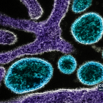 Imagem científica de arquivo — partículas do vírus Nipah (azul) junto de uma célula VERO infetada (roxo). Micrografia colorizada pelo NIAID; não documenta a consulta técnica de 2026.