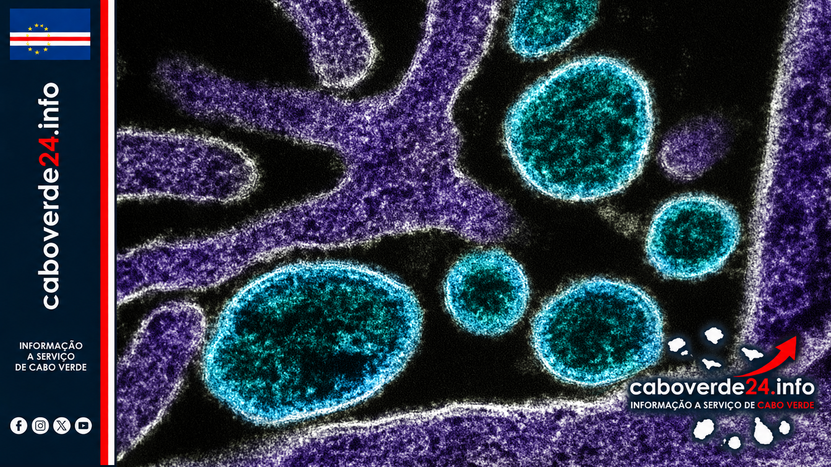 Imagem científica de arquivo — partículas do vírus Nipah (azul) junto de uma célula VERO infetada (roxo). Micrografia colorizada pelo NIAID; não documenta a consulta técnica de 2026.