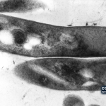 Imagem de arquivo — micrografia eletrónica de transmissão de Mycobacterium tuberculosis, agente causador da tuberculose. Não mostra um tratamento ou ensaio clínico.