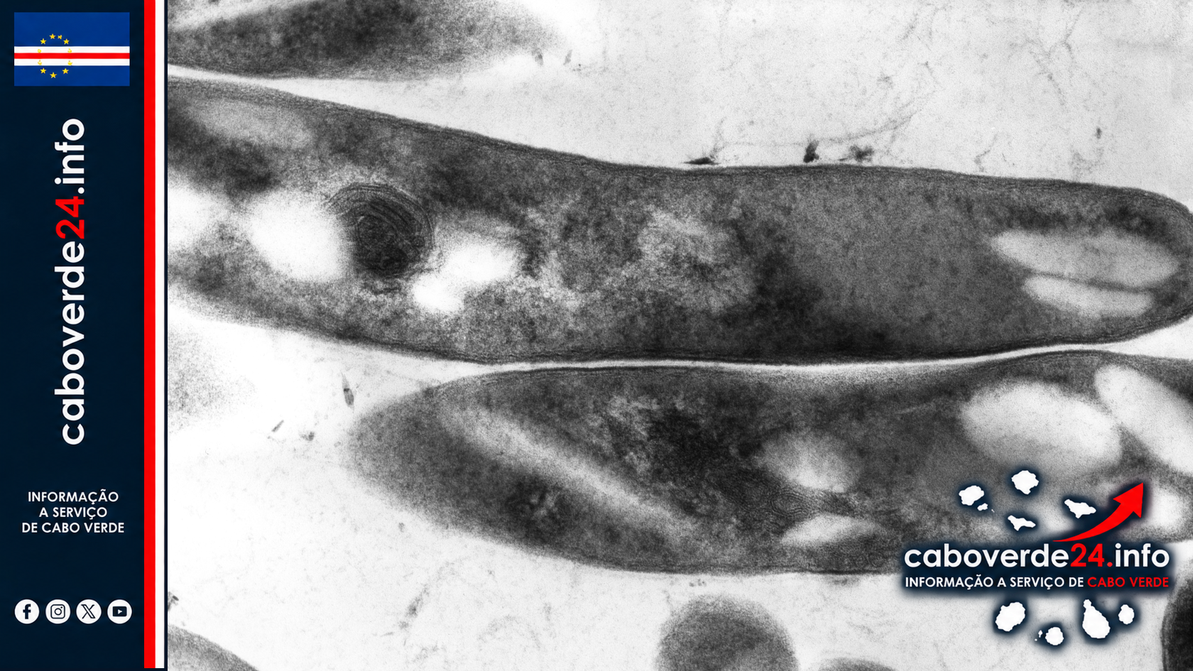 Imagem de arquivo — micrografia eletrónica de transmissão de Mycobacterium tuberculosis, agente causador da tuberculose. Não mostra um tratamento ou ensaio clínico.